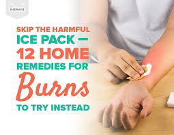Skip The Harmful Ice Pack 12 Home Remedies For Burns To Try Instead