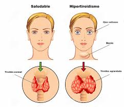 Resultado de imagen para imagenes de farmacos antitiroideos
