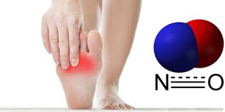 Guerir le diabete en 5 minutes. Du Monoxyde D Azote A Liberation Regulee Pour Accelerer La Guerison Des Ulceres Du Pied Diabetique E Pansement