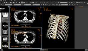 Athena dicom essential marks a new generation of software to view and manipulate medical images. Onis