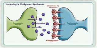 Neuroleptic Malignant Syndrome Assignment Point