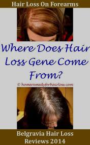 Being a user of several hair loss treatment from formulas/programs out there, i thought it would be wise to share my experience and knowledge by honest and unbiased reviews on all hair loss products, especially the popular ones on the internet and elsewhere. 11 Hair Loss Ideas Hair Loss Lost Hair Help Hair Loss