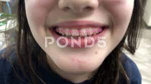 Pond5