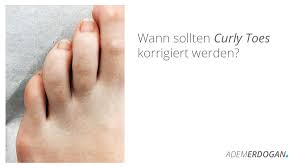 Curly Toes Verdrehte Zehen Eine Zehenfehlstellung Adem Erdogan