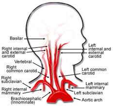 The right and left subclavian arteries give the ascending cervical artery arises from the inferior thyroid artery, as it turns medially in the neck. Carotid Artery Disease Surgical Specialists Of Southwest Florida