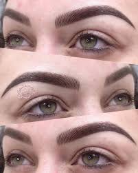 Estética in Nordeste