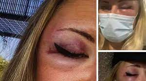 Enquête ouverte après des plaintes pour agressions sexuelles dans une. Agression D Une Jeune Femme Habillee En Jupe A Strasbourg Un Fait Divers Malheureux Ojim Fr