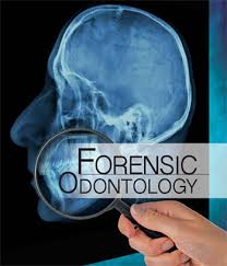 Forensic Odontology Solving Crimes One Tooth At A Time By John Piakis Dds D Abfo Forensics Forensic Science Dentaltown