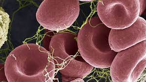 Symptoms of blood clots depend on the cause and location of the clot and the cause and include pain, redness, and swelling in the leg, chest pain, shortness of breath, and a rapid pulse if it's in the lung. Gpsf8bfupuo09m