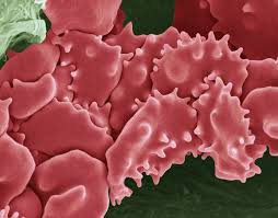 Check spelling or type a new query. What Is A Hypertonic Solution
