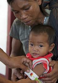 Prevention and Treatment of Severe Acute Malnutrition in East Asia and the  Pacific