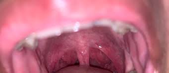 I feel this info is pretty damn important for most people to know, so share what you have, please. I Always Feel As If I Have A Lump In My Throat Does It Look Normal Should I Be Worried Askmedical