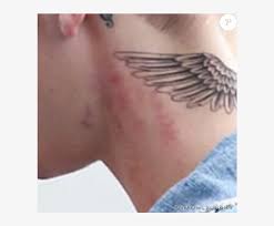 Justin bieber is a fan of religious tattoos and his chest cross is just another proof. Justin Bieber Et Ses Rougeurs Decembre Justin Bieber Tattoo Ense 950x597 Png Download Pngkit