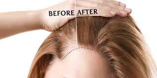 The inversion method is based on the idea that blood flow is an important factor for consistent hair growth. Bizarre Ways To Stimulate Hair Growth Youbeauty