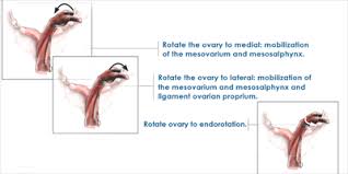 Using Osteopathy To Diagnose And Correct A Displaced Ovary In The Grumpy Mare Ivc Journal