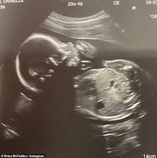 View the profiles of people named brian parkinson. Freedomroo Brian Mcfadden And Fiancee Danielle Parkinson Share Sonogram Of Baby Australiannewsreview