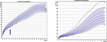 Growth Hormone Deficiency In Children With Antenatal Bartter