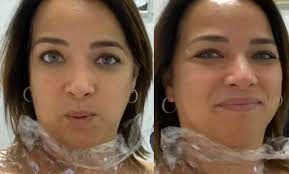 Adamari Lopez Se Quita Las Verrugas Del Cuello Y Muestra El Resultado Fama