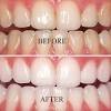 As long as you're breathing, your teeth should be gleaming. 1