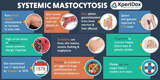 Find Doctors Hospitals And Clinical Trials For Systemic Mastocytosis Learn About Causes Symptoms Mast Cell Mast Cell Activation Syndrome Low Histamine Diet