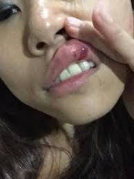 Unhappy ending: Massage parlour blow up