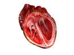 Freshly oxygenated blood leaves the left side of the heart through the ascending aorta—the largest artery. File Cg Heart Gif Wikipedia