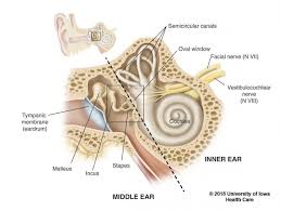 Image result for Bacterial Labyrinthitis