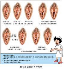 漫画）处女膜破裂的各种形状- hanhesong - 原创作品- 视觉中国(爱视觉)