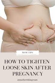 Abdominoplasty, or tummy tuck surgery, is an option to tighten muscles and remove excess skin. How To Tighten Loose Skin After Pregnancy