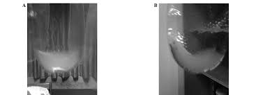 Image result for Expressed Prostatic Secretion