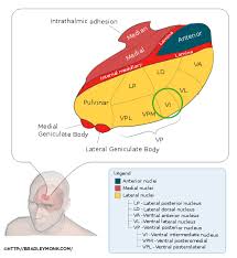 Image result for Essential Tremor