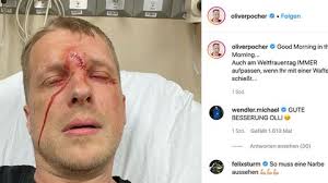 Dieser wird ihre wunde medizinisch fachgerecht behandeln und ihnen gegebenenfalls ein schmerzmittel verabreichen. Verletzungen Der Haut Geschnitten Geschurft Geprellt Stern De