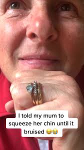 This whole video is a mess 😂 #fyp #funny #bruise #challenge #ily  #blindinglights