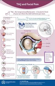 Ignorant Oral Surgeon Cosmetics Teethwhiteningkits Oralsurgeoncosmetics In 2020 Tmj Corrective Jaw Surgery Temporomandibular Joint