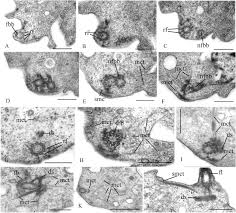 Maybe you would like to learn more about one of these? Insights Into The Origin Of Metazoan Multicellularity From Predatory Unicellular Relatives Of Animals Biorxiv