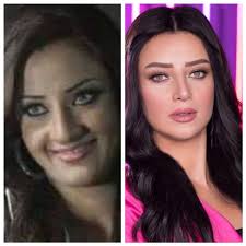 أحدث اطلالات جمالية لـ رضوى الشربيني على انستغرام قبل اصابتها بفيروس كورونا. Ø±Ø¶ÙˆÙ‰ Ø§Ù„Ø´Ø±Ø¨ÙŠÙ†ÙŠ Ù‚Ø¨Ù„ Ø¹Ù…Ù„ÙŠØ§Øª Ø§Ù„ØªØ¬Ù…ÙŠÙ„ Ø´ÙƒÙ„Ù‡Ø§ Ù‚Ø¯ ÙŠØµØ¯Ù…Ùƒ