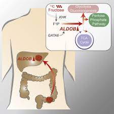 Once treatments meant to halt colon cancer are no longer working, and is considered terminal, it is important to know what to expect. Aldolase B Mediated Fructose Metabolism Drives Metabolic Reprogramming Of Colon Cancer Liver Metastasis Sciencedirect