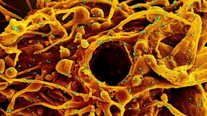 Chile reporta caso en viajera. Que Se Sabe De La Nueva Variante India Del Coronavirus Es Mas Transmisible Escapa A Las Vacunas