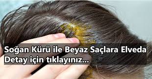 Sogan Kuru Ile Beyaz Saclara Son Beyaz Sac Sac Saglik