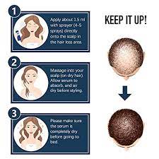 And so, the more you drink, the more your hair weakens. Hair Growth Spray Lamfun Professional Hair Loss Treatment 5 Minoxidil Solution For Hair Loss Thinning Regrowth And Balding Topical Treatment For Men And Women Alcohol Free And Non Oily 100ml Pricepulse