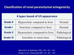 Chronic Kidney Disease | Radiology Reference Article | Radiopaedia.Org