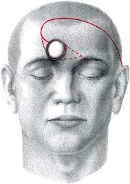 Tumor Operations of the Face and Scalp