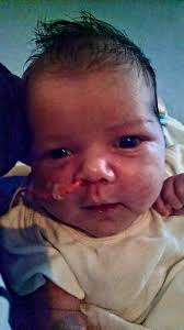 Adalynn Elena Hebert's Gastroshisis Journey