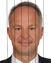 Langzeitergebnisse der Septorhinoplastik