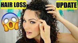 My Pcos Hair Loss Update The Glam Belle Youtube