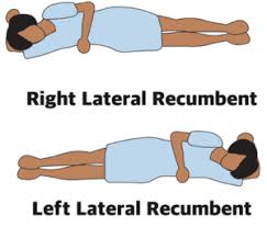 In this study, left lateral decubitus came out on top. Lying Position Lateral Florida Cna Online Course