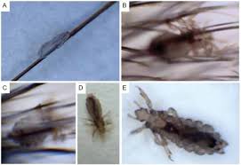 Nematodes translucent small clear worm. Larva Migrans An Overview Sciencedirect Topics