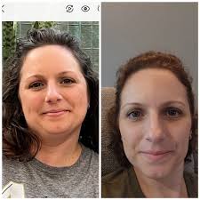 weight loss after bariatric surgery