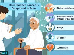 Blood in urine (hematuria), which may cause urine to appear bright red or cola colored, though the type of bladder cell where cancer begins determines the type of bladder cancer. Bladder Cancer In Men Symptoms And Diagnosis