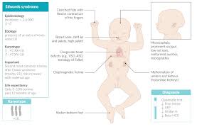Edwards' syndrome is associated with the presence of a third copy of chromosome number 18. Chromosomal Aberrations Amboss